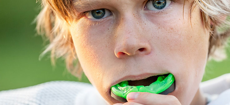 mouthguard-for-physical-activity