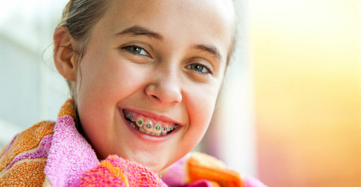 3-Reasons-to-Get-Braces-in-Summer-featured
