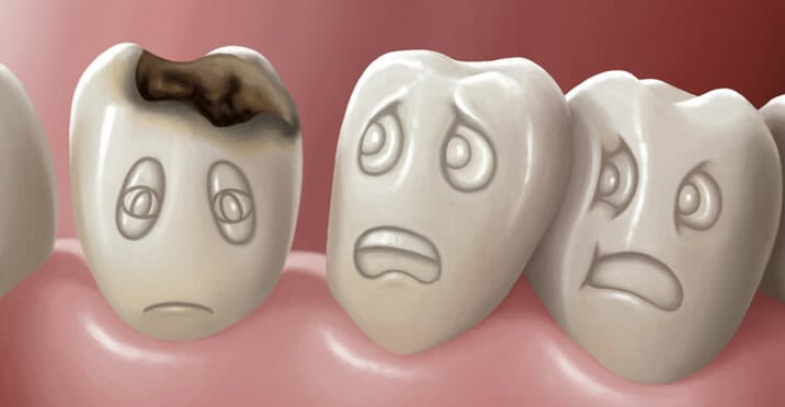 spread-of-cavities