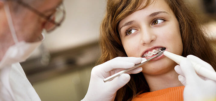 Braces Removal Process