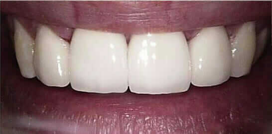 improved oral health