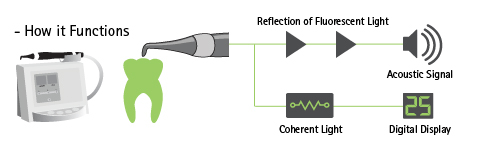 How it works