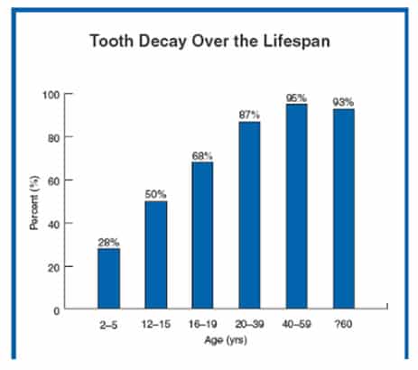 tooth decay over the lifespan
