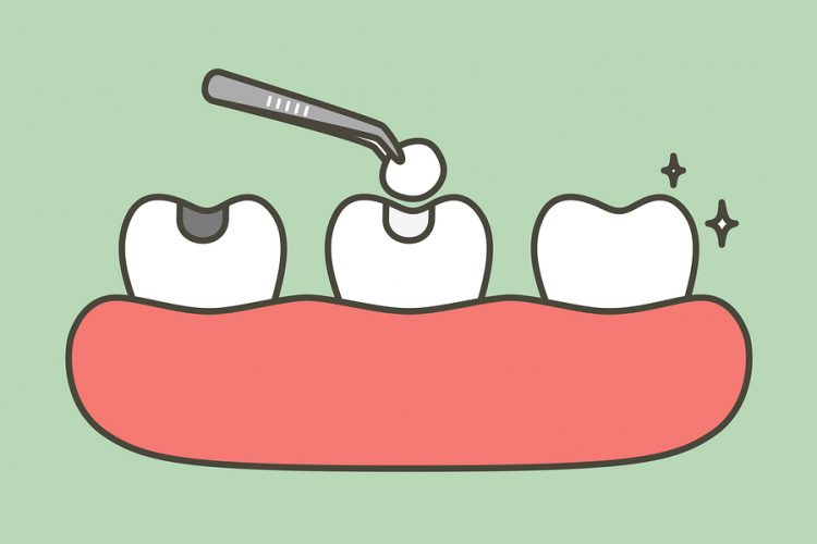 8 Common and Surprising Things That Can Ruin Your Teeth