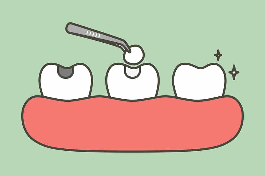 8 Common and Surprising Things That Can Ruin Your Teeth