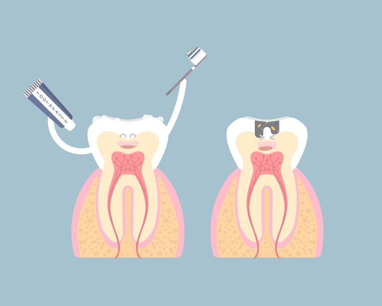 7 Common Diseases That Cause Tooth Decay (and How to Prevent It)