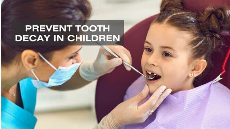 How to Prevent Tooth Decay in Children