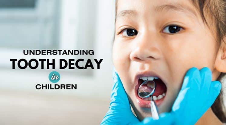 Understanding Tooth Decay in Children