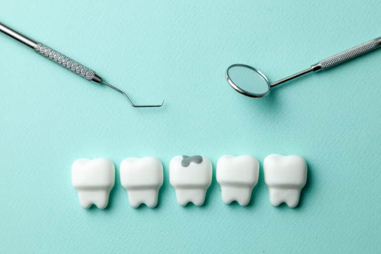 How Long Can a Cavity Go Untreated?